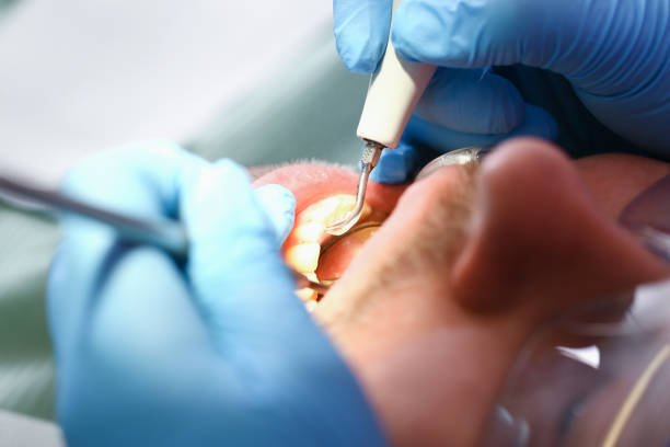 Best Root Canal Emergency Dentist  in Bethany, IL