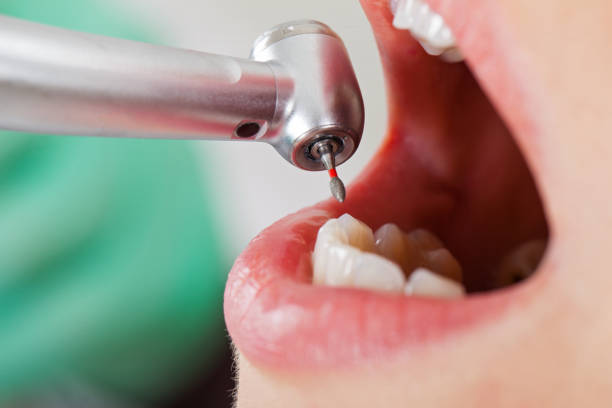 Best Dentist for Tooth Abscess  in Bethany, IL